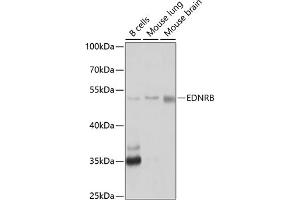 Western blot analysis of extracts of various cell lines, using EDNRB antibody (ABIN3016961, ABIN3016962, ABIN1679650 and ABIN6219903) at 1:1000 dilution. (EDNRB anticorps  (AA 1-100))