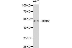Western blot analysis of extracts of A-431 cells, using DDB2 antibody (ABIN5970947) at 1/1000 dilution. (DDB2 anticorps)