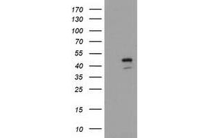 Image no. 1 for anti-serpin Peptidase Inhibitor, Clade B (Ovalbumin), Member 4 (SERPINB4) antibody (ABIN1500891) (SERPINB4 anticorps)