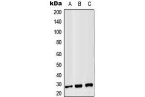 Western blot analysis of CD8b expression in Jurkat (A), Raw264. (CD8B anticorps  (Center))