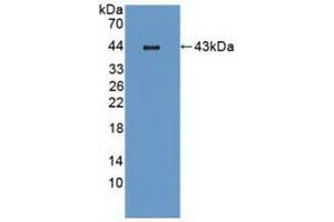 Detection of Recombinant MIP3b, Mouse using Polyclonal Antibody to Macrophage Inflammatory Protein 3 Beta (MIP3b)