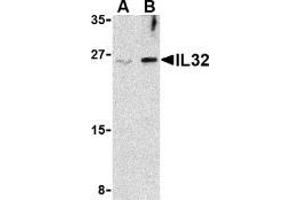 Western blot analysis of IL-32 in Jurkat cell lysate with AP30425PU-N IL-32 antibody at (A) 2. (IL32 anticorps  (Intermediate Domain))