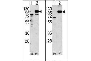 (LEFT)Western blot analysis of APP (arrow) using rabbit polyclonal APP Antibody (N-term). (APP anticorps  (C-Term))