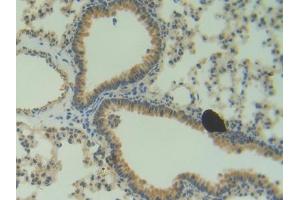 DAB staining on IHC-P; Samples: Mouse Lung Tissue (ANG anticorps  (AA 25-145))