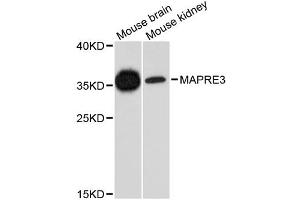 Western blot analysis of extracts of various cell lines, using MAPRE3 antibody. (MAPRE3 anticorps)