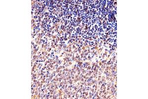 Immunohistochemical analysis of paraffin-embedded M. (Cyclin B1 anticorps  (AA 103-130))
