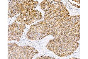 Immunohistochemistry (IHC) image for anti-Neural Cell Adhesion Molecule 1 (NCAM1) (AA 20-318) antibody (ABIN7449431)