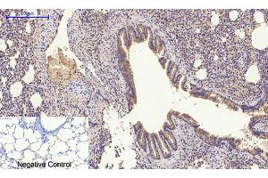 Immunohistochemical analysis of paraffin-embedded rat lung tissue. (GLUT4 anticorps  (N-Term))