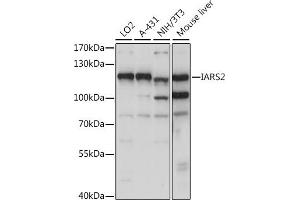 anti-Isoleucyl-tRNA Synthetase 2, Mitochondrial (IARS2) (AA 663-1012) antibody