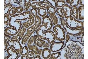 ABIN6278976 at 1/100 staining Rat kidney tissue by IHC-P. (ACAA2 anticorps  (Internal Region))