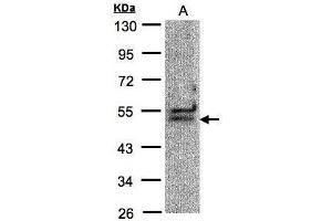 WB Image Sample(30 μg of whole cell lysate) A:Hep G2, 10% SDS PAGE antibody diluted at 1:1000 (DDX39B anticorps)