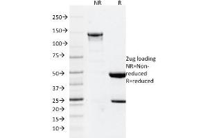 SDS-PAGE Analysis Purified GFAP Mouse Monoclonal Antibody (GFAP/2076).