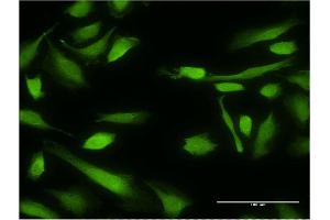 Immunofluorescence of monoclonal antibody to XIAP on HeLa cell.
