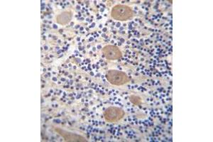 anti-E2F-Associated Phosphoprotein (AA 203-233), (C-Term) antibody