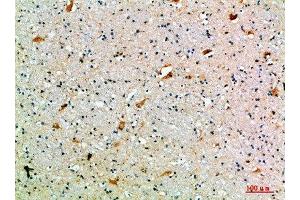 Immunohistochemical analysis of paraffin-embedded human-brain, antibody was diluted at 1:200 (SEMA7A anticorps  (AA 101-150))