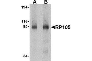 Western Blotting (WB) image for anti-CD180 Molecule (CD180) (C-Term) antibody (ABIN1030626) (CD180 anticorps  (C-Term))