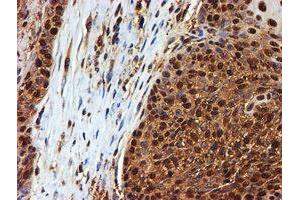 Image no. 1 for anti-Proteasome (Prosome, Macropain) Subunit, beta Type, 9 (Large Multifunctional Peptidase 2) (PSMB9) (AA 21-219) antibody (ABIN1491194)