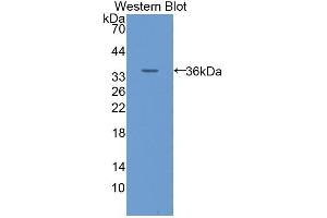 Detection of Recombinant GLUT14, Human using Polyclonal Antibody to Glucose Transporter 14 (GLUT14) (SLC2A14 anticorps  (AA 51-105))