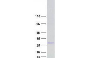 Validation with Western Blot
