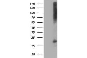 Western Blotting (WB) image for anti-Destrin (Actin Depolymerizing Factor) (DSTN) antibody (ABIN1497911) (Destrin anticorps)