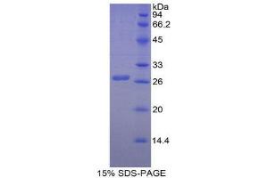 SDS-PAGE (SDS) image for Myosin Light Chain Kinase (MYLK) (AA 1661-1877) protein (His tag,GST tag) (ABIN1879233)