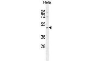 SMYD1 Antibody (C-term) western blot analysis in Hela cell line lysates (35µg/lane). (SMYD1 anticorps  (C-Term))