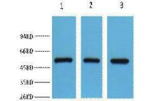 Western Blotting (WB) image for anti-Fumarate Hydratase (FH) antibody (ABIN3181264) (FH anticorps)