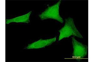 Immunofluorescence of purified MaxPab antibody to SGTA on HeLa cell. (SGTA anticorps  (AA 1-313))