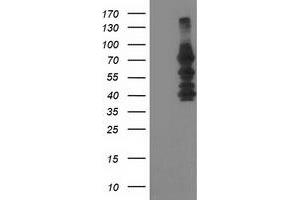 Western Blotting (WB) image for anti-Katanin P80 (WD Repeat Containing) Subunit B 1 (KATNB1) antibody (ABIN1498991) (KATNB1 anticorps)