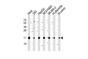 All lanes : Anti-IFITM3 Antibody (N-term) at 1:2000 dilution Lane 1: Hela whole cell lysate Lane 2: 293 whole cell lysate Lane 3: HepG2 whole cell lysate Lane 4: NCI- whole cell lysate Lane 5: SK-BR-3 whole cell lysate Lane 6: human placenta lysate Lane 7: mouse colon lysate Lysates/proteins at 20 μg per lane. (IFITM3 anticorps  (N-Term))