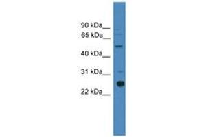 Image no. 1 for anti-Zinc Finger, Matrin Type 2 (ZMAT2) (C-Term) antibody (ABIN6745451)