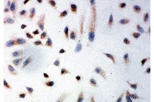 Anti-Prohibitin antibody, ICC ICC: HELA Cell