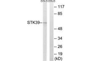 Western blot analysis of extracts from COLO205 cells, using STK39 Antibody. (STK39 anticorps  (AA 351-400))