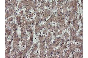 Image no. 2 for anti-Protein Disulfide Isomerase Family A, Member 3 (PDIA3) antibody (ABIN1498107)