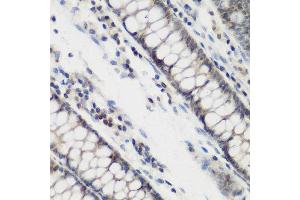 Immunohistochemistry of paraffin-embedded human colon using DHODH antibody at dilution of 1:200 (40x lens). (DHODH anticorps)
