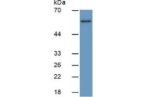 Rabbit Detection antibody from the kit in WB with Positive Control:  Sample Human Placenta lysate.