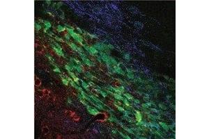 Multiplex staining of KCa3.