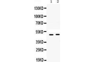 Western blot analysis of SFRP4 expression in A549 whole cell lysates (lane 1) and SW620 whole cell lysates (lane 2).