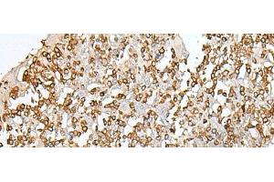 Immunohistochemistry of paraffin-embedded Human tonsil tissue using SEPT1 Polyclonal Antibody at dilution of 1:50(x200) (Septin 1 anticorps)