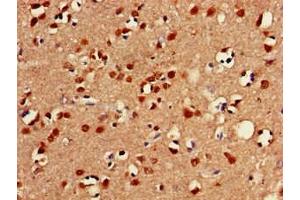 Immunohistochemistry of paraffin-embedded human brain tissue using ABIN7153026 at dilution of 1:100