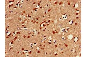 Immunohistochemistry of paraffin-embedded human brain tissue using ABIN7153026 at dilution of 1:100 (FOXC2 anticorps  (AA 24-294))