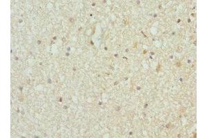 Immunohistochemistry of paraffin-embedded human brain tissue using ABIN7172077 at dilution of 1:100