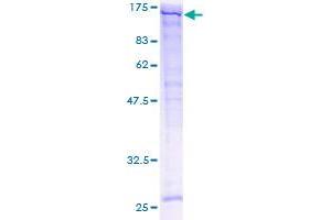 Image no. 1 for SPARC-Like 1 (Hevin) (SPARCL1) (AA 18-664) protein (GST tag) (ABIN1321086)