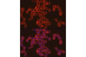 Immunofluorescence analysis of THP-1 cells using Cathepsin G Rabbit pAb (ABIN6127687, ABIN6139229, ABIN6139231 and ABIN6221273) at dilution of 1:50 (40x lens).