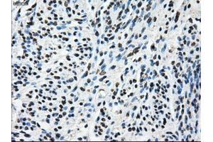 Immunohistochemical staining of paraffin-embedded Ovary tissue using anti-TTLL12mouse monoclonal antibody. (TTLL12 anticorps)