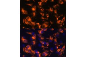Immunofluorescence analysis of C6 cells using Somatostatin Receptor 2 (SSTR2) Polyclonal Antibody (ABIN7270493) at dilution of 1:100 (40x lens).