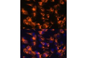 Immunofluorescence analysis of C6 cells using Somatostatin Receptor 2 (SSTR2) Polyclonal Antibody (ABIN7270493) at dilution of 1:100 (40x lens). (SSTR2 anticorps  (C-Term))