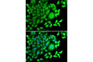 Immunofluorescence analysis of MCF7 cell using CD47 antibody. (CD47 anticorps)