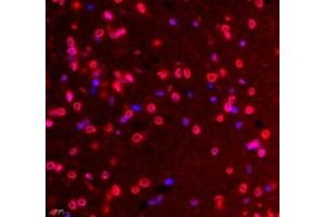 Immunofluorescence of paraffin embedded rat hippocampus using Tuba3a (ABIN7076051) at dilution of 1: 600 (400x lens (Tuba3a anticorps)