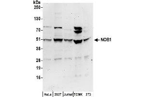 anti-RNA-Binding Protein NOB1 (NOB1) (AA 362-412) antibody